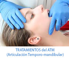 Tratamientos del ATM (Articulación Temporo-mandibular)